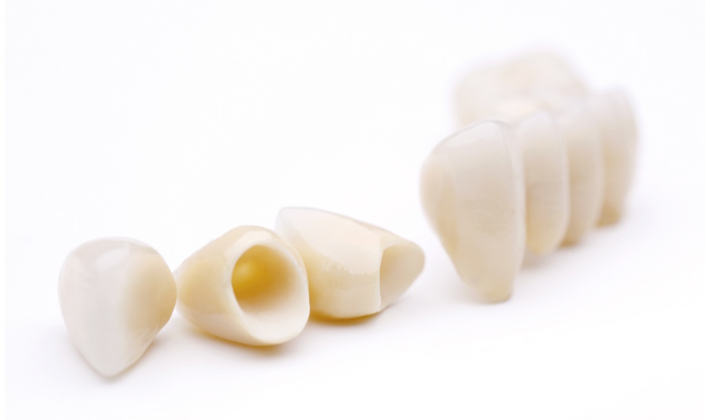 Протезирование зубов - керамические коронки